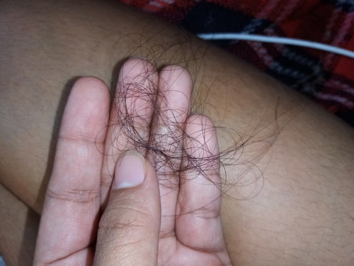 Fallen Hair ?