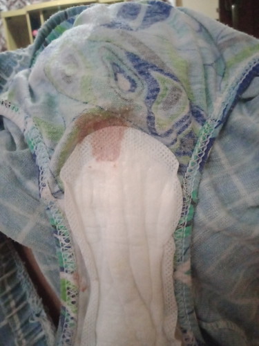 Bleeding or spotting?