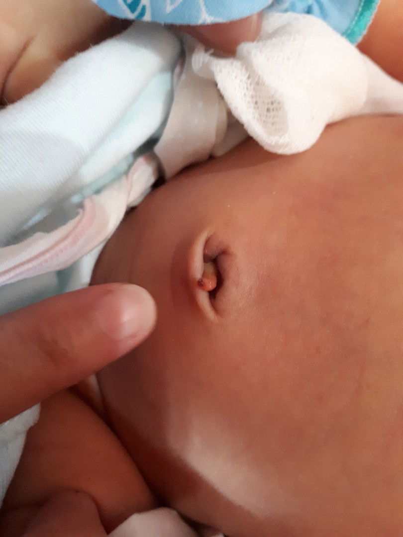 Pusar Puput tapi belum kering dan ada yg tersisa