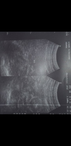 gender ni baby