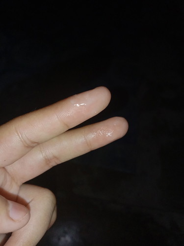 ตกขาว