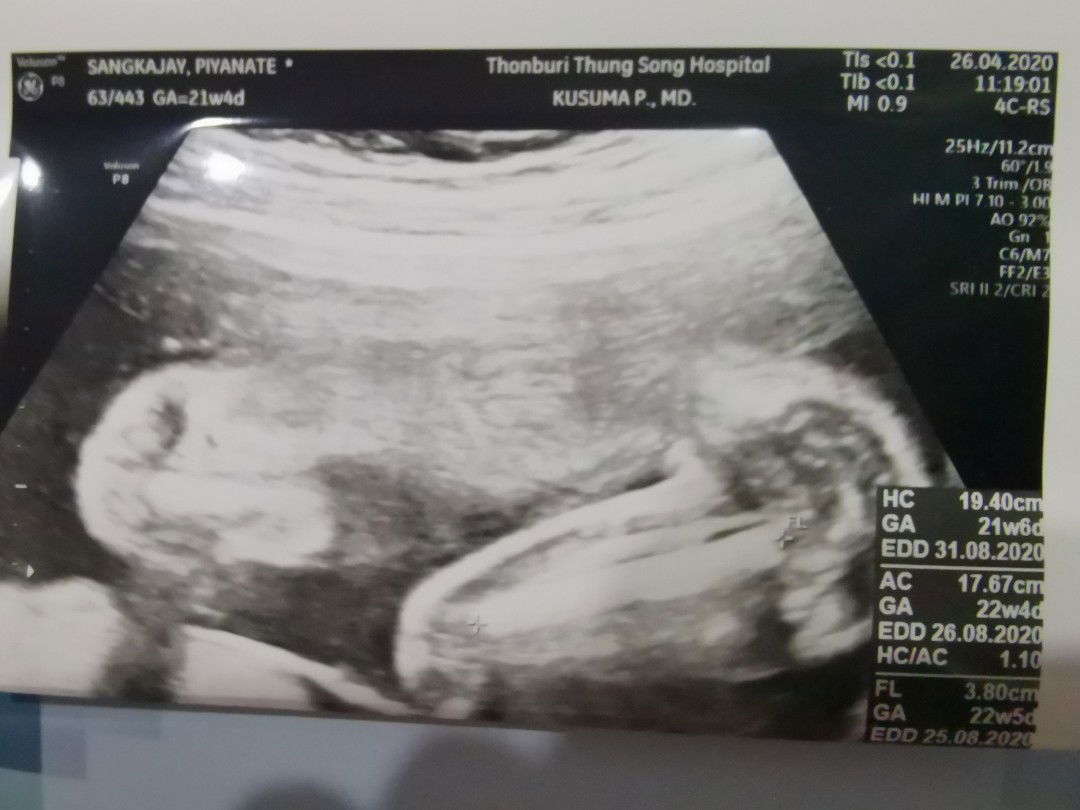 21วีคแล้ว...ทำไมหนูไม่ให้แม่ดูเพศคะลูก