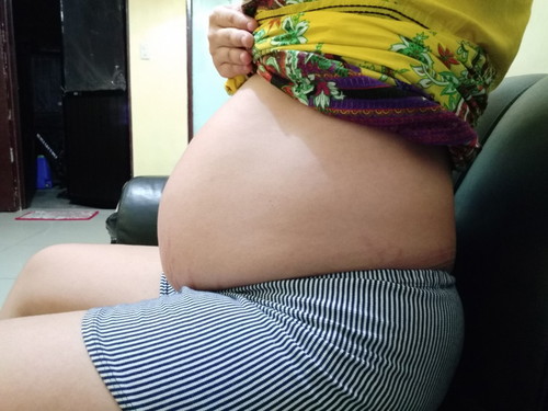 Malaki po ba para sa 33weeks and 4 days?