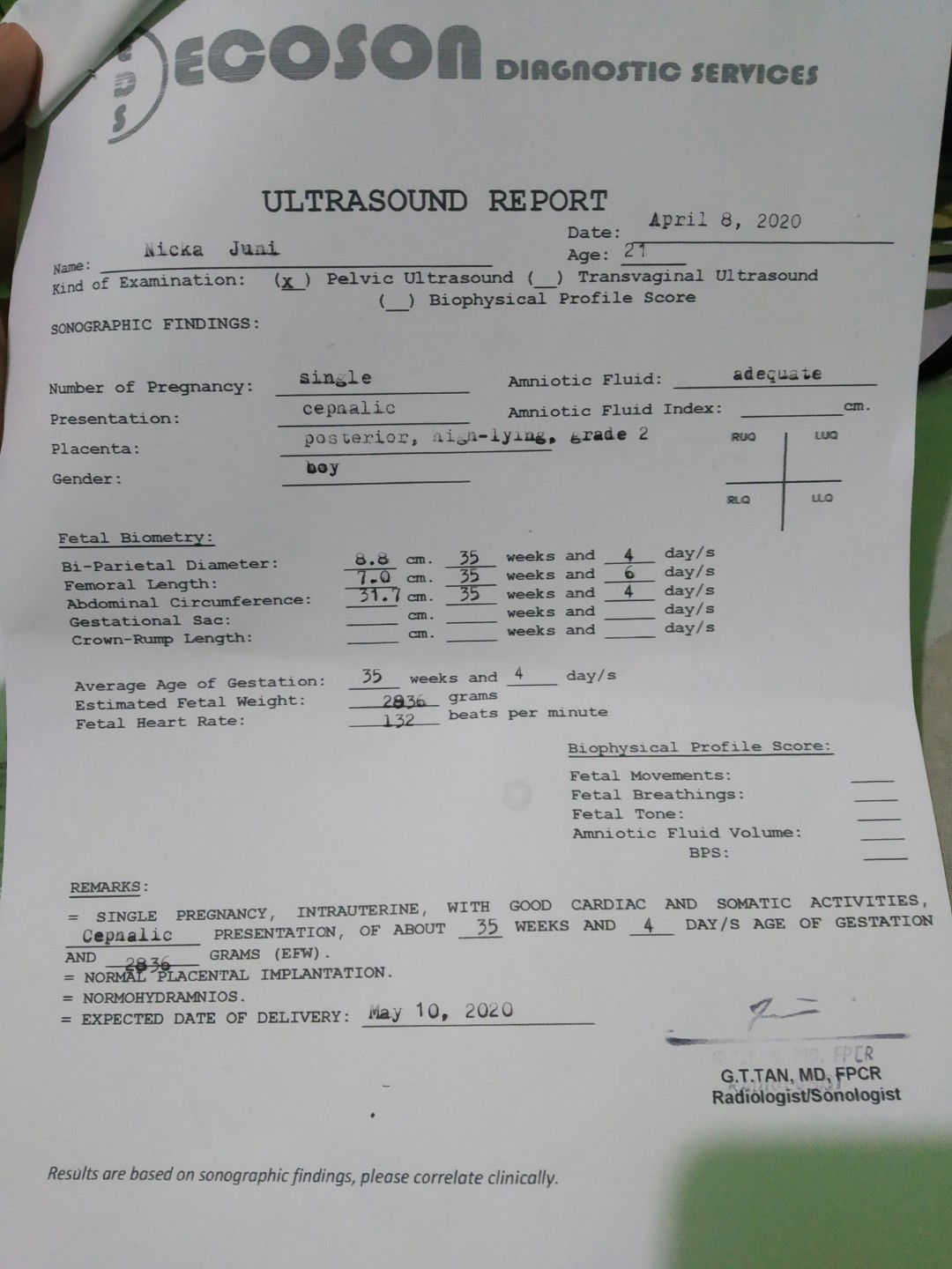 34weeks & 6days (EDD May 14, 2020)