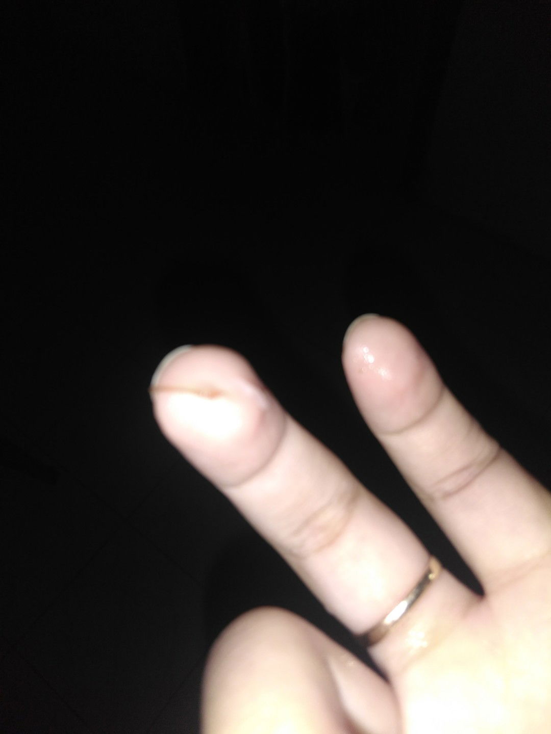 keputihan berserta ada warna coklat dikit