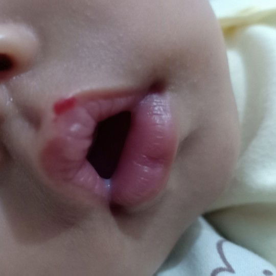 bibir bayi