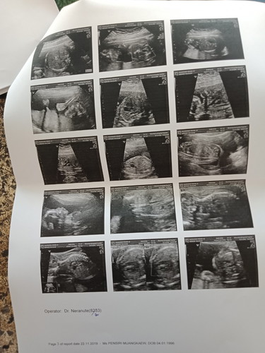 คุณแม่บ้านไหนเคยเจอเคสแบบแม่บ้านนี้บ้างค่ะ ช่วยแนะนำหน่อยค่ะ