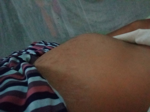 ดันท้อง