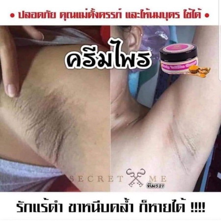 หมดปัญหารักแร้ดำ แค่ทาครีมไพรsecretme