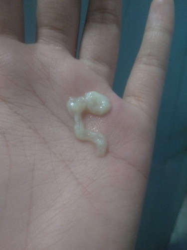 36+2w