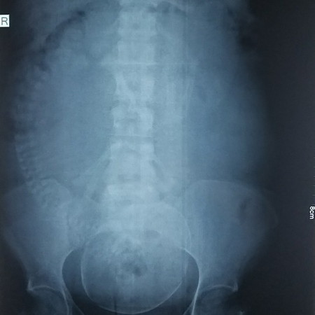 nasa tamang posisyon ba si baby?