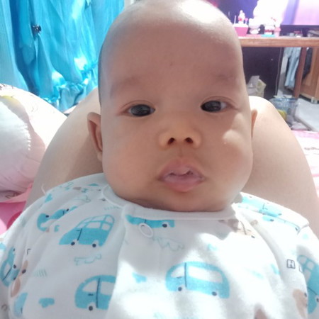 ปากเปื่อย