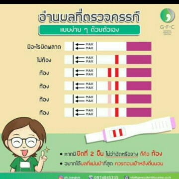 คำถามยอดนิยม