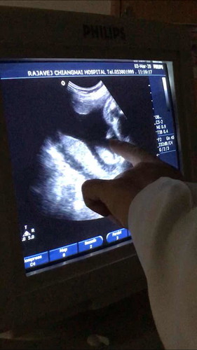 สอบถามหน่อยค่ะ