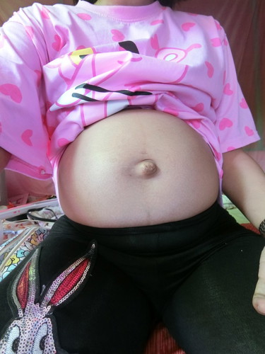 ตกเลือดหลังคลอด