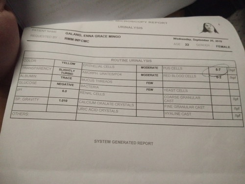 urinalysis result.