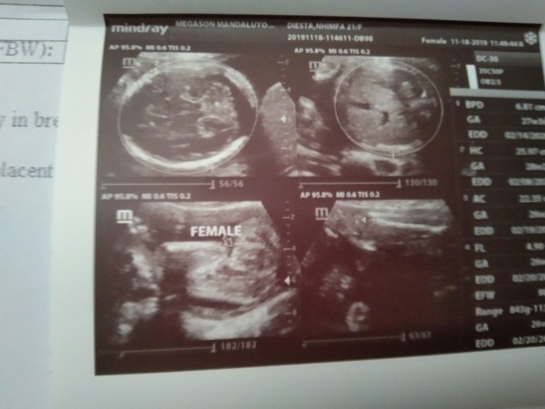 hapyyyyyy(^^)(^^)(^^)