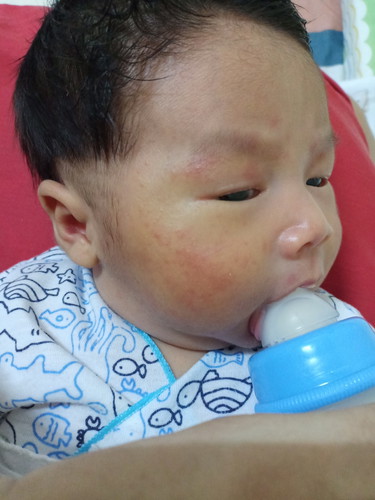 ตุ่มอะไรเอ่ย