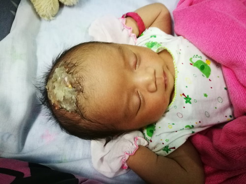 หอมแดงแปะหัวทารกแรกเกิดผิดไหมครับ