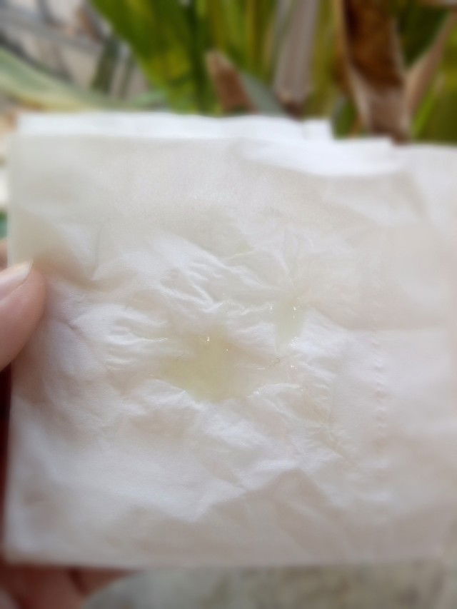 มูกหรือตกขาว