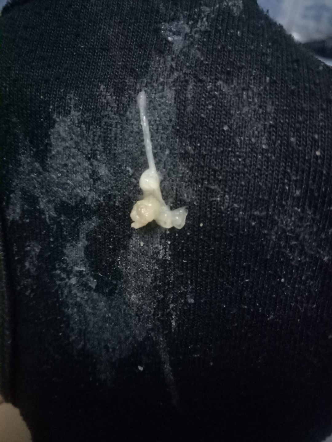 ตกขาวหรือมูกค่ะ