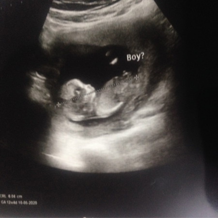 เพศลูกค่ะ