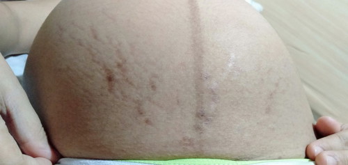 Dark Spots