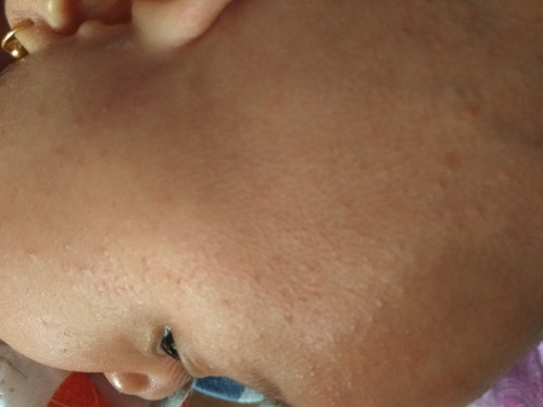 Biang keringat kah ??