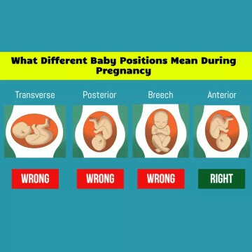 Tranverse Position 5 months pregnant