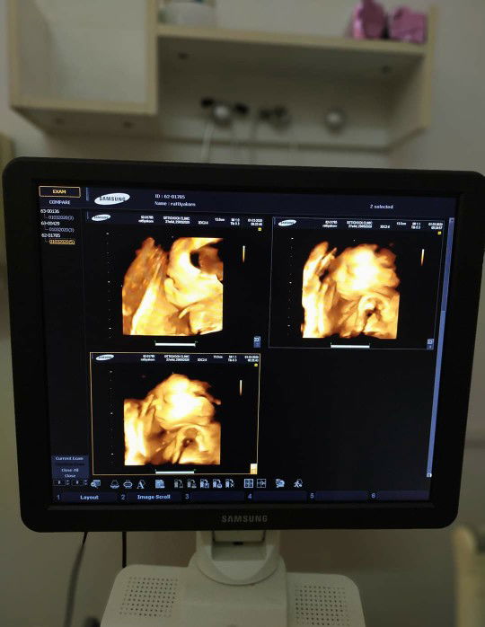 มีลูกๆบ้านไหนหวงหน้าเหมือนบ้านนี้บ้างคะ