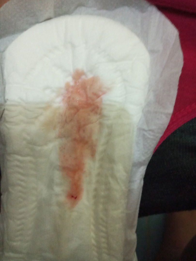 39weeks and 5dyas  may nalabas na dugo at subra sakit ng puson at balakang parang natatae.