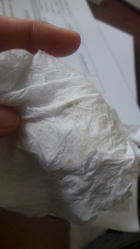 ยอสอดกันแท้ง