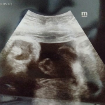 คุณแม่ช่วยดูเพศหน่อยค่ะ☺☺☺