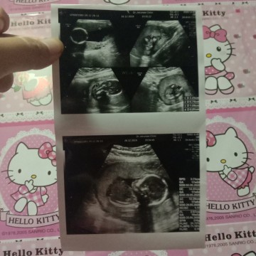 น้ำคล่ำแห้ง