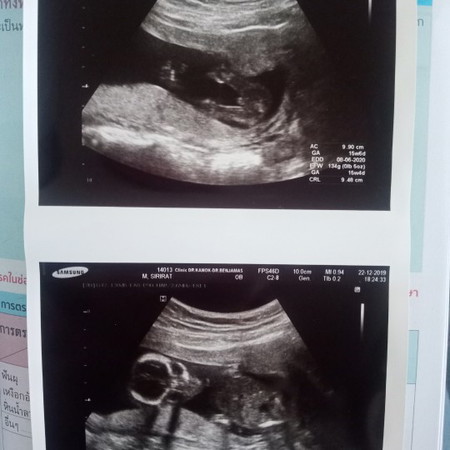 แบบนี้จะชายหรือหญิงนะ