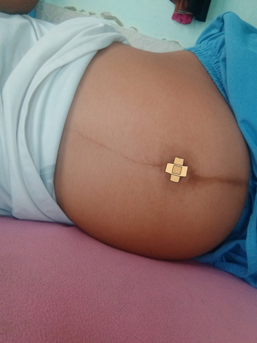 ขอดูท้องหน่อย