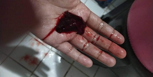 Scared. ?