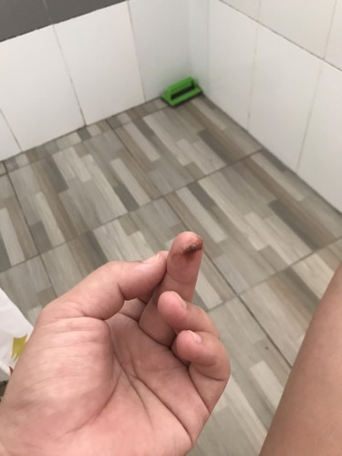 39+1 อาการไกล้คลอดไหมค่ะ