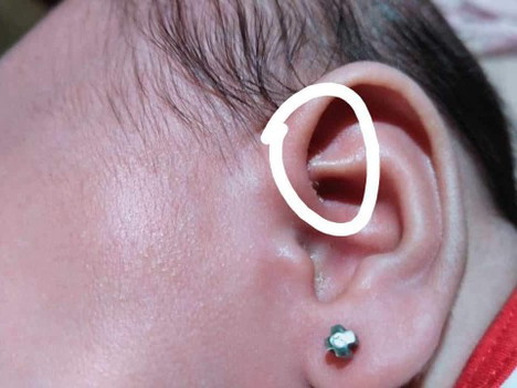 parang namamalat banda sa tenga