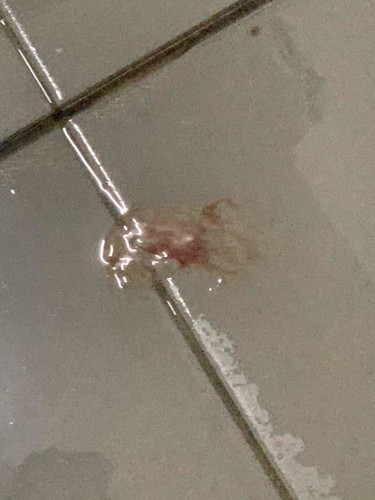 Perlu ke hospital atau tak ?