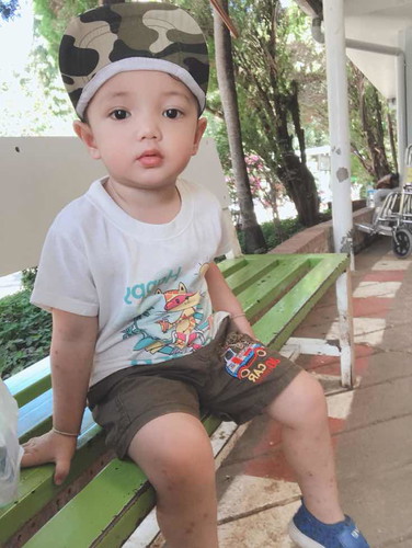 เด็กกับไส้เลื่อน