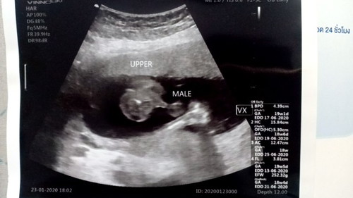 19+3 weeks จะเห็นเพศลูกชัดยังคะ
