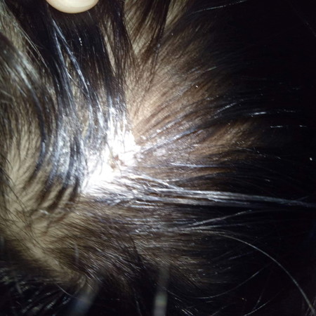 Butlig Na Parang Nana Pag Natuyo