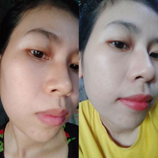 mẹ bỉm sữa da xấu.