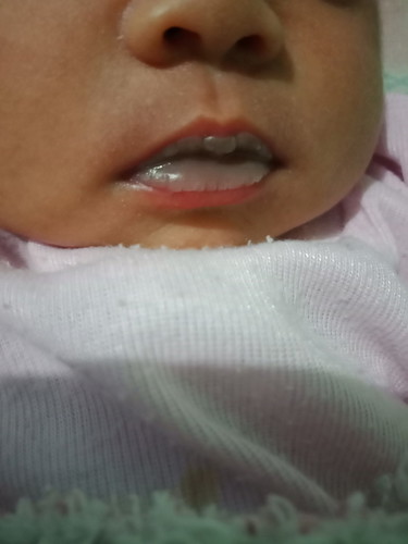 bibir bayi