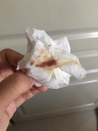 36+4แล้วค่ะ มีมูกเลือดออกมาพร้อมตกขาว