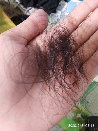 rontok rambut