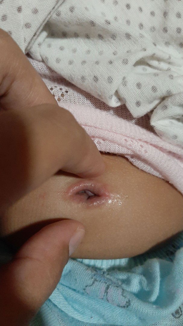 puser anak berair trus