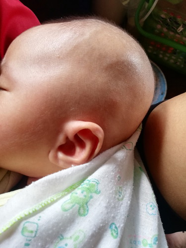 กลัวลูกหัวแบน