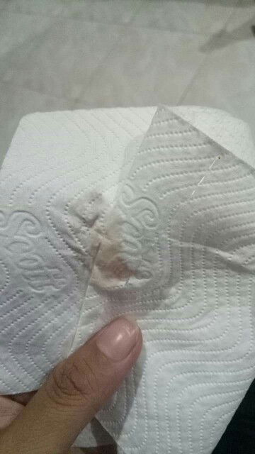 ขออนุญาติสอบถามนะค่ะ พอดีเราไปลอยกระทงมาแต่ก็ไม่ได้เดินเยอะอะไร แต่เรารู้สึกปวดหลัง เรากลับมาถึงบ้านเข้าห้องน้ำฉี่ เห็นมีอะไรหยดในชักโครก พอเราเช็ดดูก็เป็นตามรูปภาพ เราตั้งได้ทั้งหมด 6สัปดาห์. 6วัน  มีแบบนี้ออกมาจะเป็นรัยมั้ยค่ะตอนนี้เครียดมาก ร้องไห้หนัก